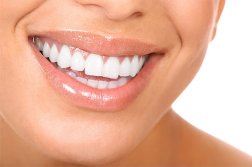 Veneers or Bonding: Which Is Right for My Smile?